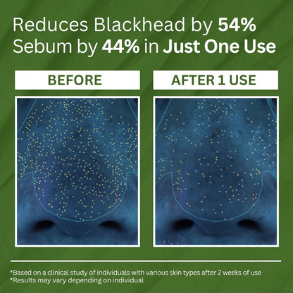 VelvetGlint™ Holy Basil Bubble Deep Mask